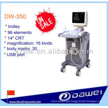 trolley full digital ultrasound with 14 inch CRT screen